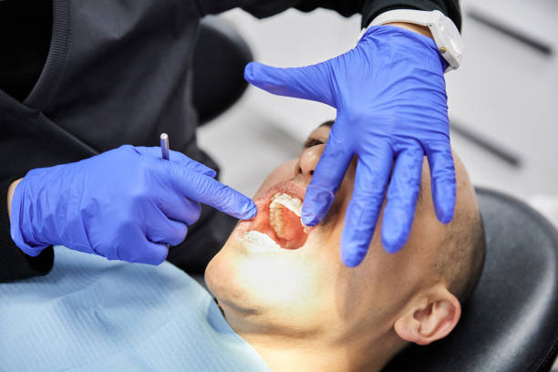 Best Emergency Treatment for Dental Infections or Abscesses in Santa Anna, TX