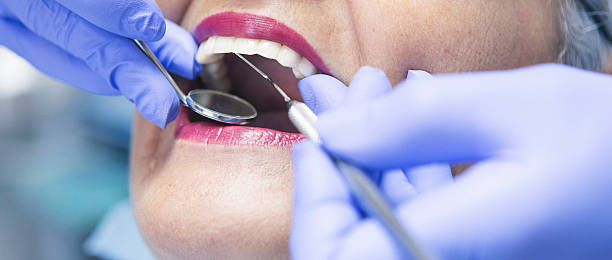 Best Emergency Tooth Extraction in Santa Anna, TX
